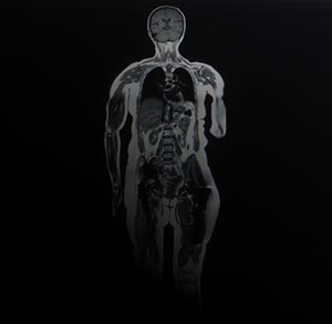 Whole Body Screening MRI in Culver City, CA