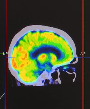 Brain PET Near Me in Culver City, CA