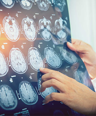 For Doctors - iVIE, MRI Screening Center in Culver City, CA