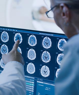 MRI Brain Screening Near Me in Culver City, CA
