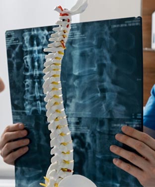 Spine MRI Near Me in Culver City, CA