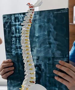 Spine MRI Near Me in Culver City, CA