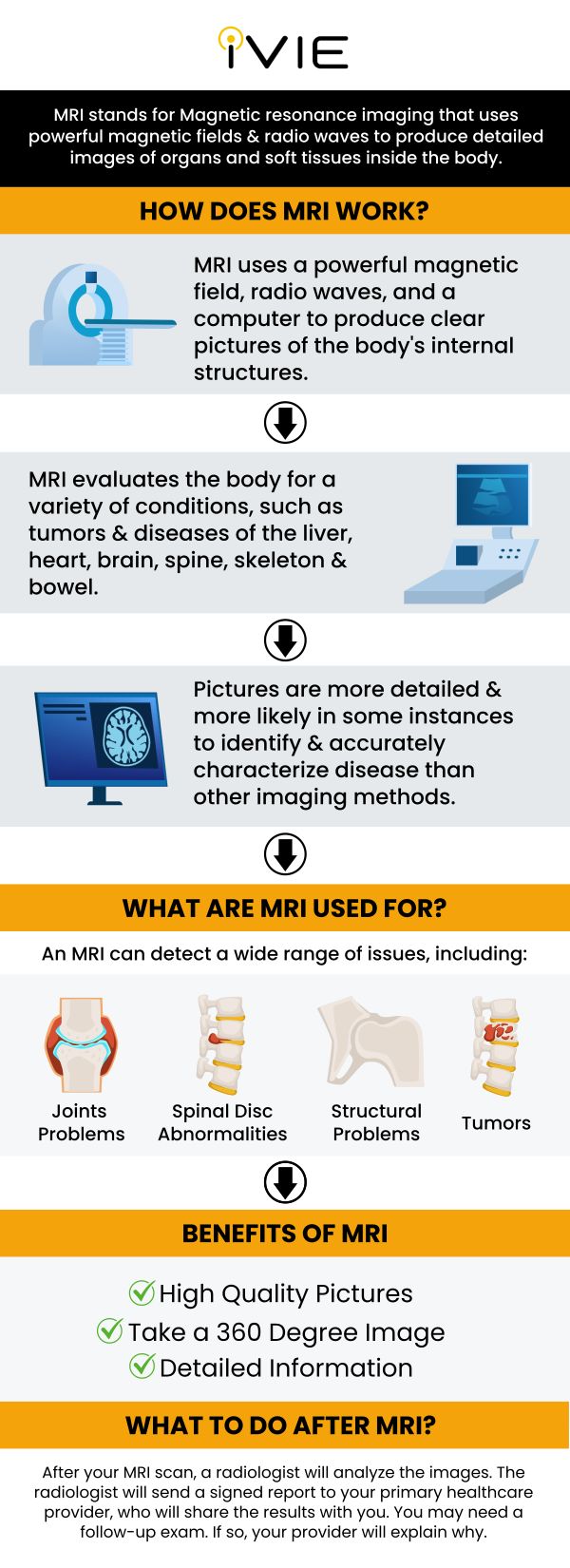 Routine screenings with whole-body MRI scans can aid in the early detection of health concerns, giving patients a higher chance of starting treatment sooner. This early detection is critical for properly managing and treating illnesses, potentially improving outcomes and quality of life. At the iVIE MRI Screening Center, Dr. Kourosh Naini and our team of knowledgeable and experienced professionals provide whole-body MRI screening. For more information, contact us or book an appointment online. We are located at 11600 Washington Pl Suite 104A, Culver City, CA 90066.