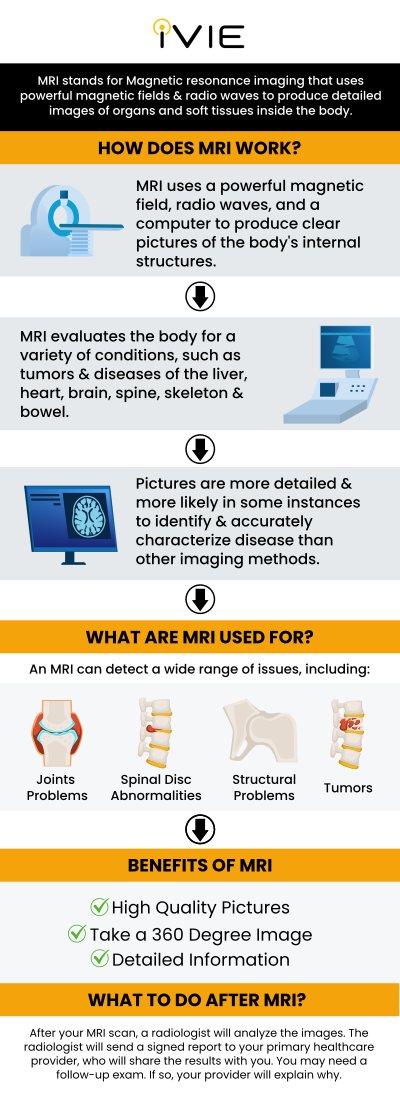 Routine screenings with whole-body MRI scans can aid in the early detection of health concerns, giving patients a higher chance of starting treatment sooner. This early detection is critical for properly managing and treating illnesses, potentially improving outcomes and quality of life. At the iVIE MRI Screening Center, Dr. Kourosh Naini and our team of knowledgeable and experienced professionals provide whole-body MRI screening. For more information, contact us or book an appointment online. We are located at 11600 Washington Pl Suite 104A, Culver City, CA 90066.