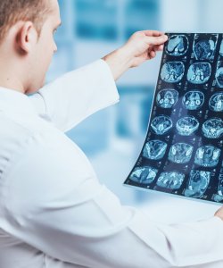 Mobile MRI Services with Expert Imaging and Interpretation Near Me in Culver City Los Angeles, CA
